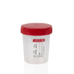 contenitore-urine